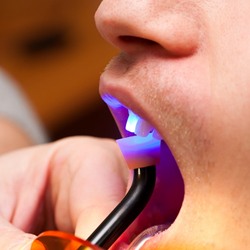 dental light