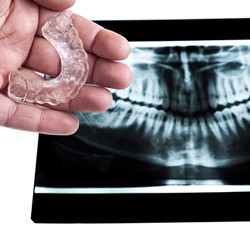 dental X-ray with a dentist holding a nightguard