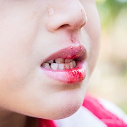 A young child bleeding from the mouth.