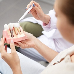 dentist showing a patient how dental implants work