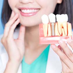 dentist holding a model of a dental implant