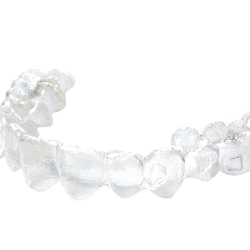 An up-close look at an Invisalign aligner designed to straighten a person’s smile