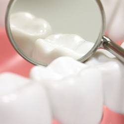 Closeup of teeth with dental sealants