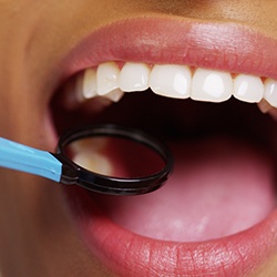 Closeup of patient's healthy smile