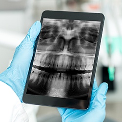 Dental x-rays on tablet computer